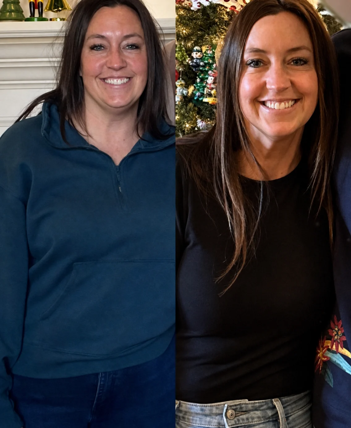 Before and after a medical weight loss program