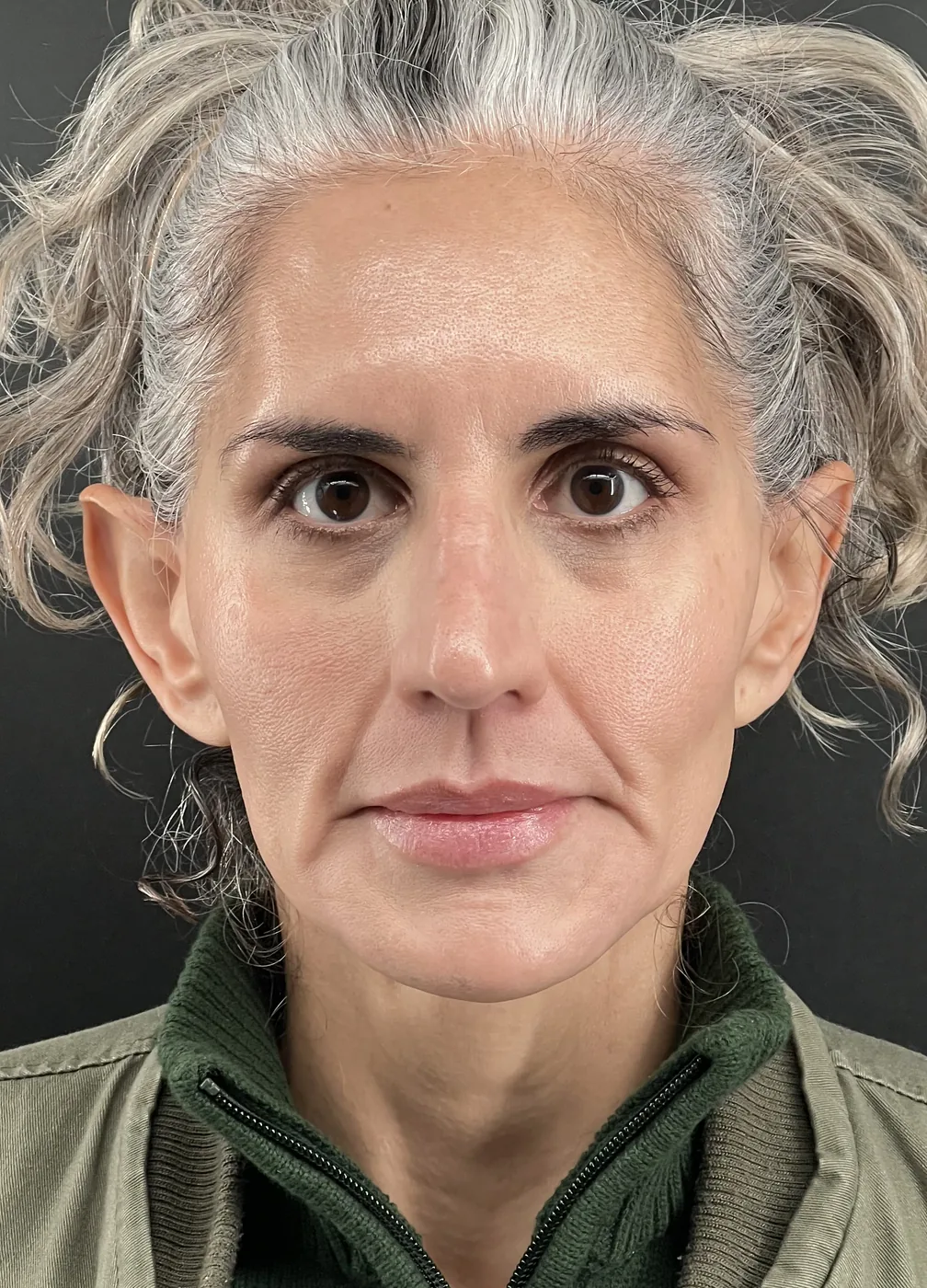 Biostimulators before treatment