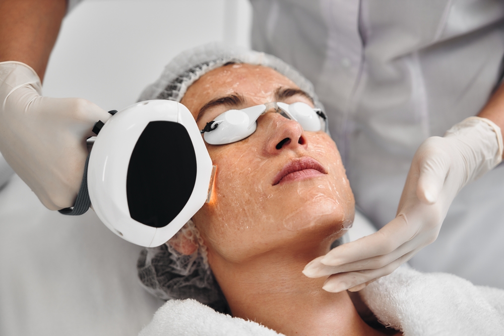 Close-up of a patient receiving an IPL Photofacial to reduce redness and even out skin tone. Close-up of a patient receiving an IPL Photofacial to reduce redness and even out skin tone.
